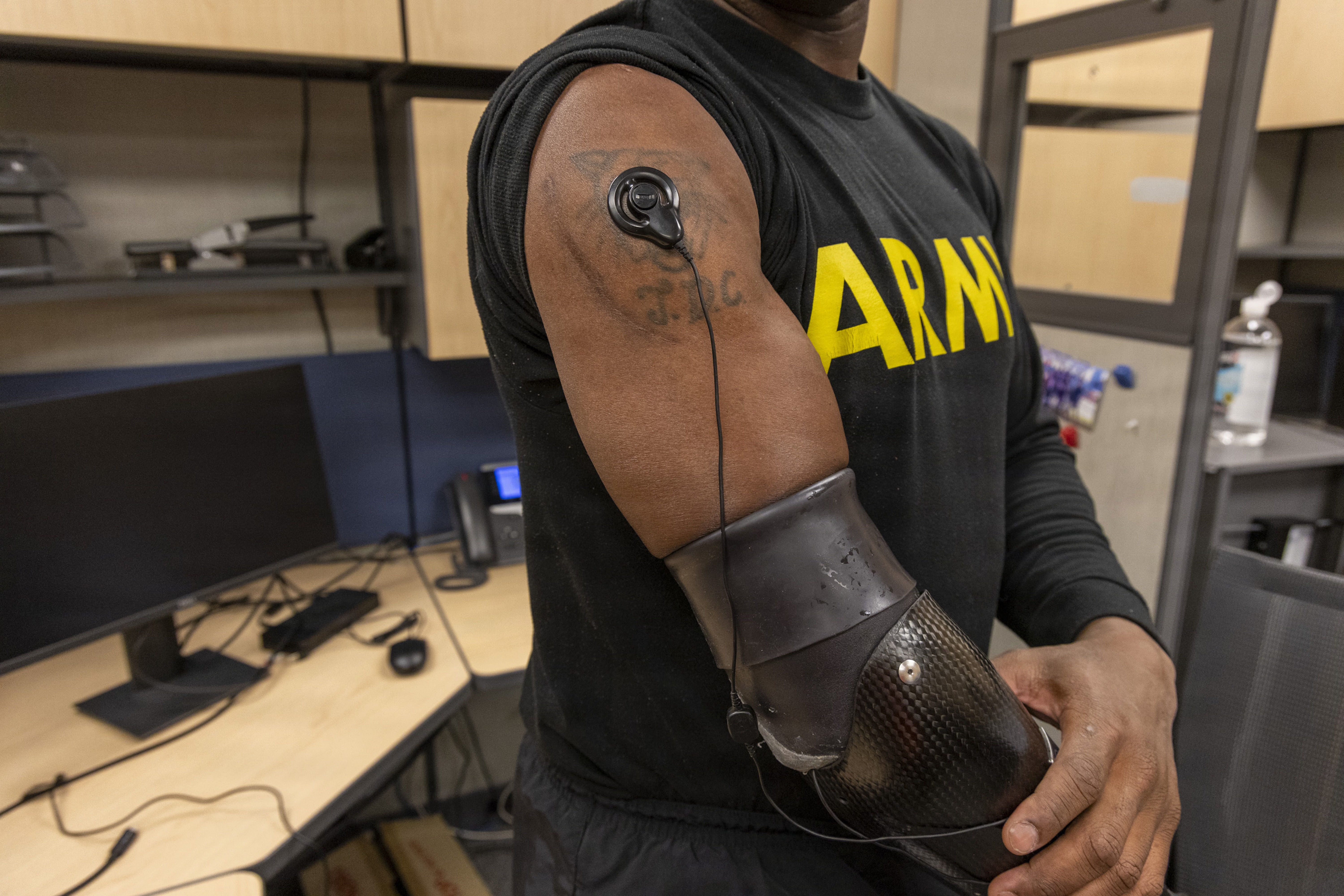 A clinical trial participant shows his “neural-enabled” prosthetic arm at Walter Reed National Military Medical Center, Oct. 22. (Ann Brandstadter)
